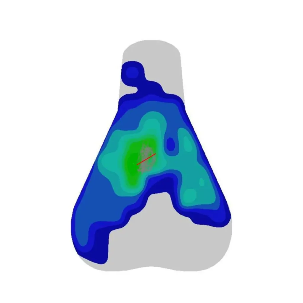 pressure mapping bike fitting